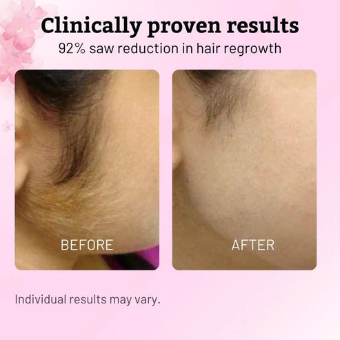 Cyperus Rotundus Skin Serum
