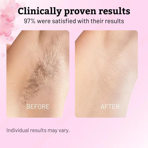 Cyperus Rotundus Skin Serum