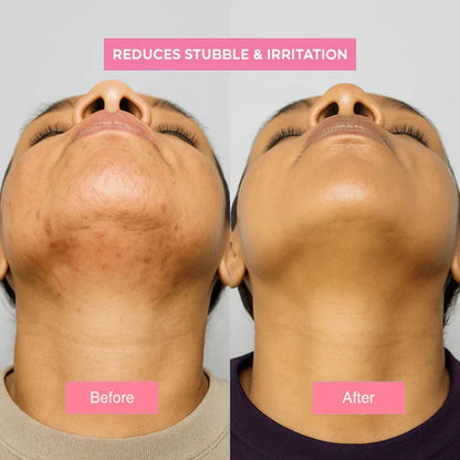 Cyperus Rotundus Skin Serum